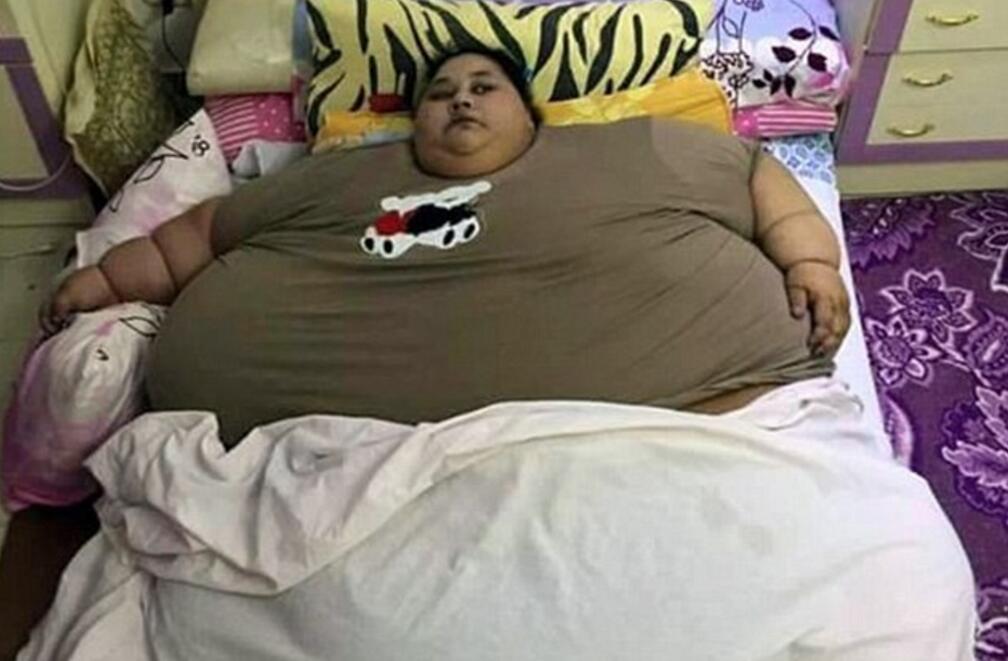 В ОАЭ умерла самая толстая жительница планеты