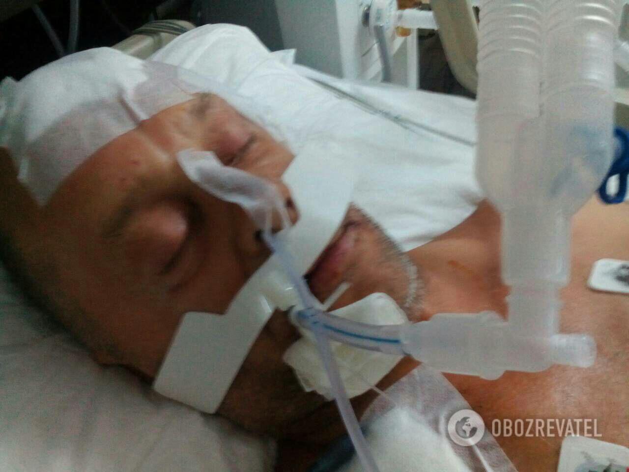 Россиянин, избивший украинца в Турции отпустили после уплаты штрафа, а житель Запорожья находится в больнице без обещанной финансовой поддержки