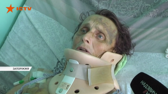 В Запорожской области рогатый скот напал на 72-летнюю бабушку: с множественными переломами женщина госпитализирована (Фото, видео)