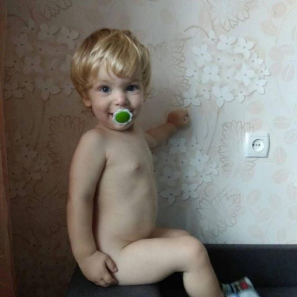 Родители мальчика из Запорожской области просят помощи: на ребенка упала кастрюля с кипятком (Фото)