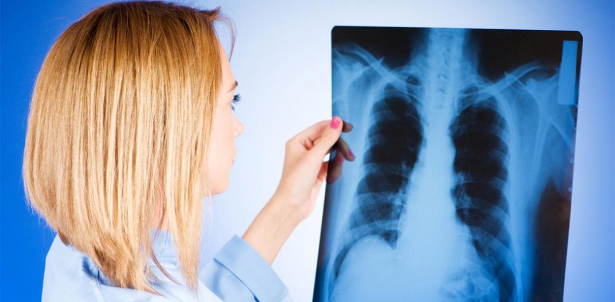 В Запорожье наблюдается рост заболеваемости туберкулезом