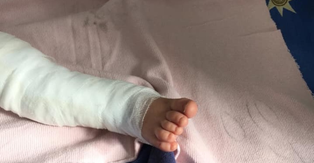 В Запорожской области 2-летний малыш пострадал из-за горящей травы: ребенок нуждается в помощи