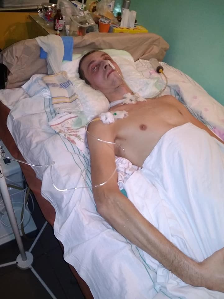 Родственники ветерана АТО, которого в Запорожье из-за замечания избили битой снова просят о помощи: у парня опухоль мозга