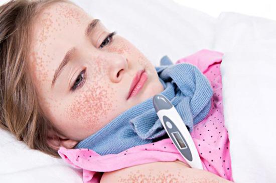 В Запорожье дети все чаще заболевают опасной инфекцией: как распознать
