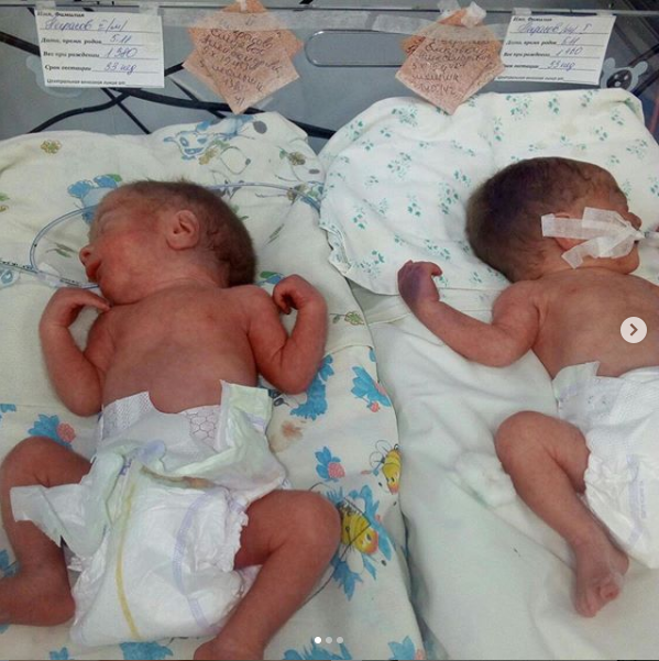 Стало известно о состоянии двойняшек, которых 15-летняя запорожанка родила раньше срока
