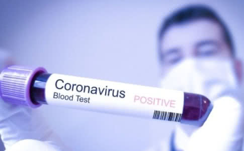 Куда, в случае заражения коронавирусом, будут госпитализировать жителей Запорожской области