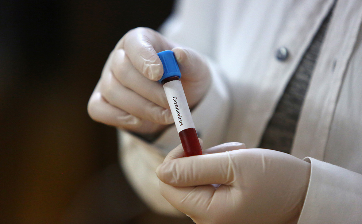 Как в Запорожье с помощью тестов проводят проверки на коронавирус