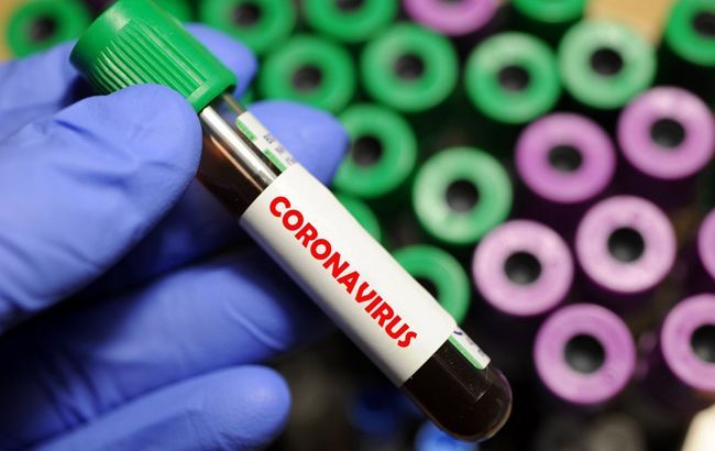 В запорожских аптеках могут появиться тесты на коронавирус