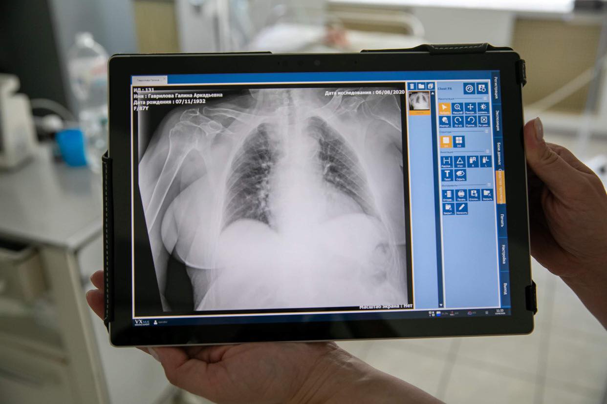 15 аппаратов ИВЛ, 3 цифровых рентген-аппаратов, 100 кислородных концентраторов: в Запорожье продолжают закупать оборудование для борьбы с COVID-19 (ФОТО)