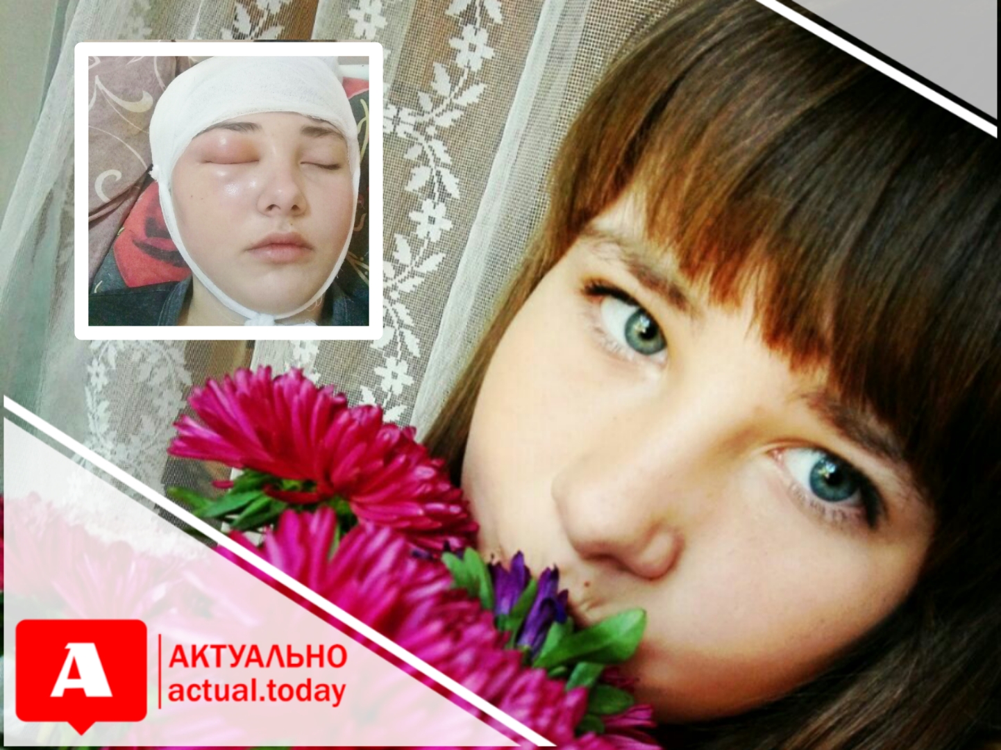 В Запорожье 11-летняя девочка, катаясь c горки, на скорости сорвалась с тюбинга и ударилась головой об дерево: ей нужна помощь
