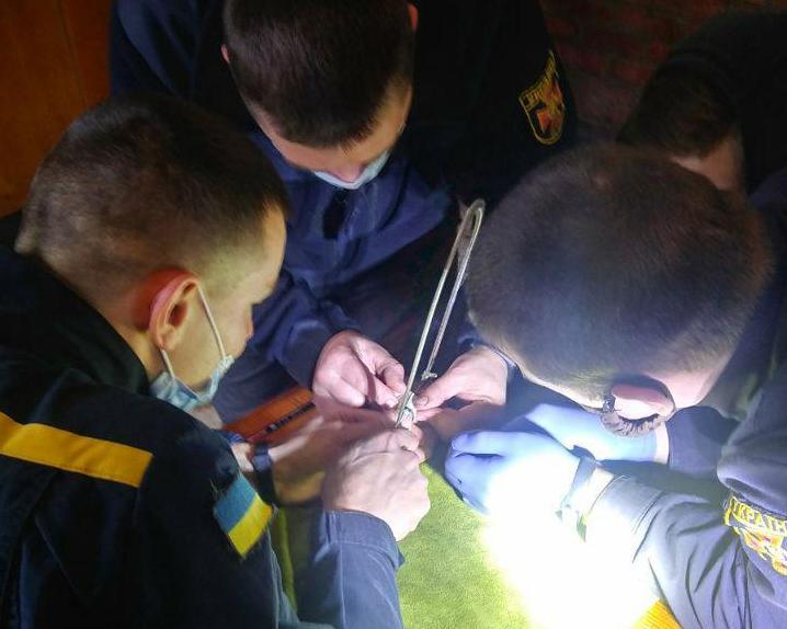 В Мелитополе спасатели освободили палец 16-летнего подростка от кольца (ФОТО)