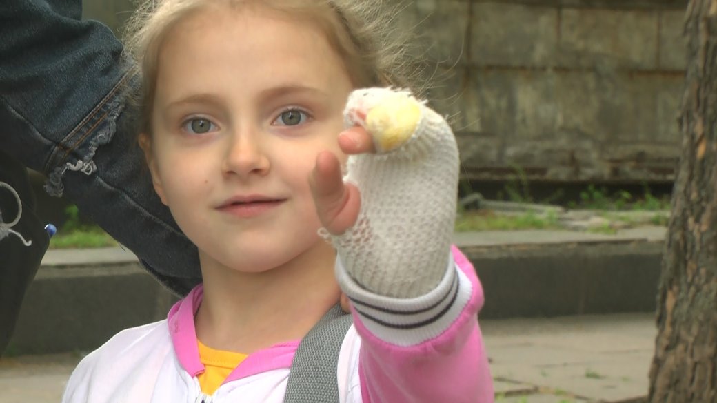 Стало известно о состоянии 6-летней девочки, которую в Энергодаре укусила змея (ФОТО)