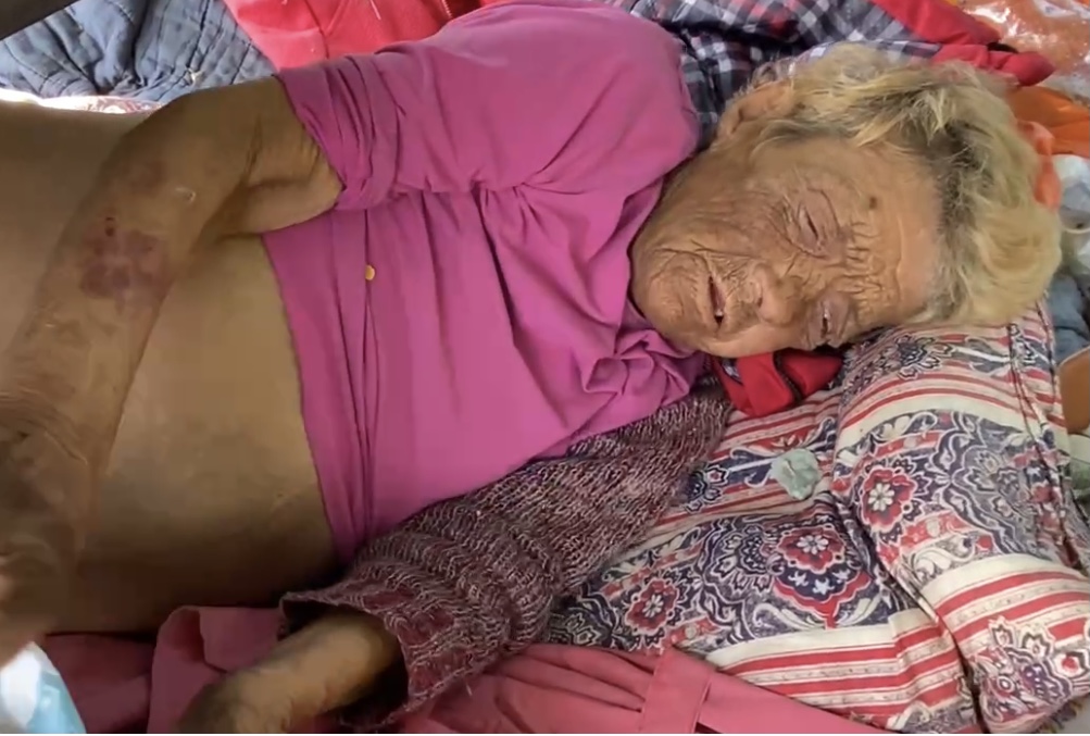 Женщина, которая почти месяц была лишена возможности передвигаться и жила на улице, умерла в запорожской больнице