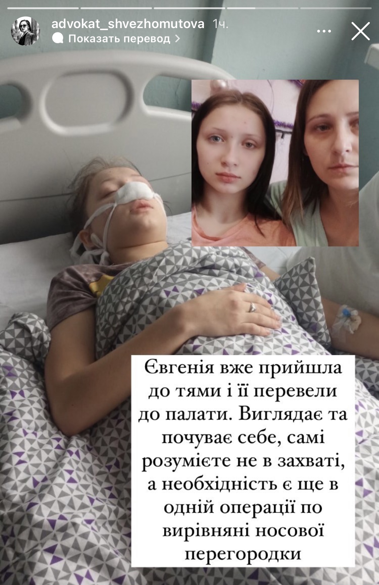 Девочке, которую в Запорожье избили подростки, провели операцию