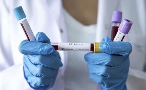 Запорожская область получит новые наборы для проведения лабораторных исследований на выявление коронавируса