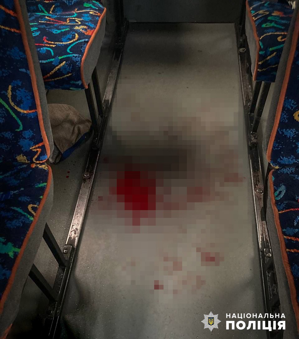 У Запоріжжі жінка в маршрутному таксі вдарила ножем в обличчя неповнолітнього (ФОТО)